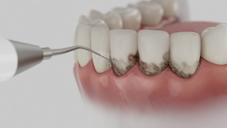 Trusted Root Canal Treatment service in Calverton Park, MO - Dentist Open Now